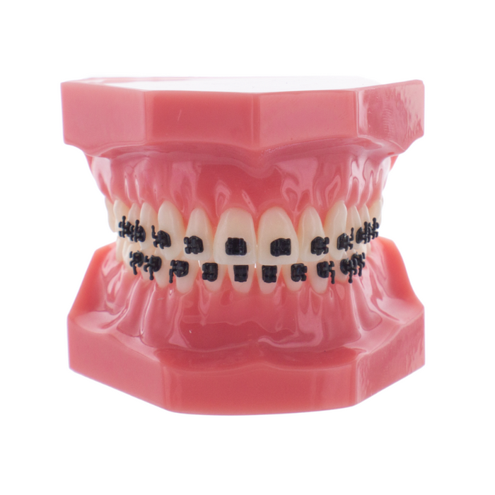 AquaMini Black MBT Set .022 HK 3/4/5