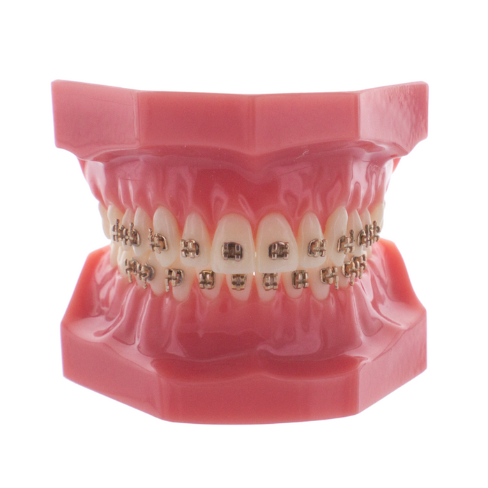 HeliosRoseGold X1 MBT Set .022 HK 3/4/5
